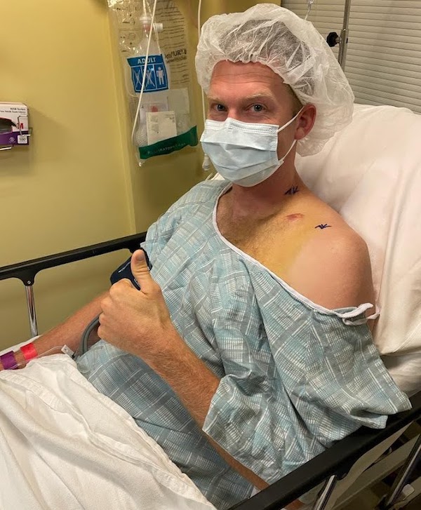 Collar bone surgery after being struck by a car while riding his bike | Photo courtesy Stephen Dunn